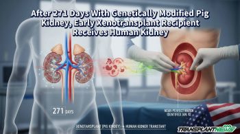 After 271 Days With Genetically Modified Pig Kidney, Early Xenotransplant Recipient Receives Human Kidney