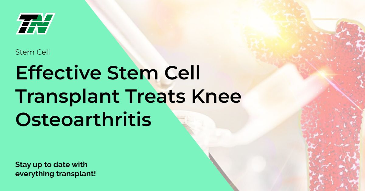 Effective Stem Cell Transplant Treats Knee Osteoarthritis