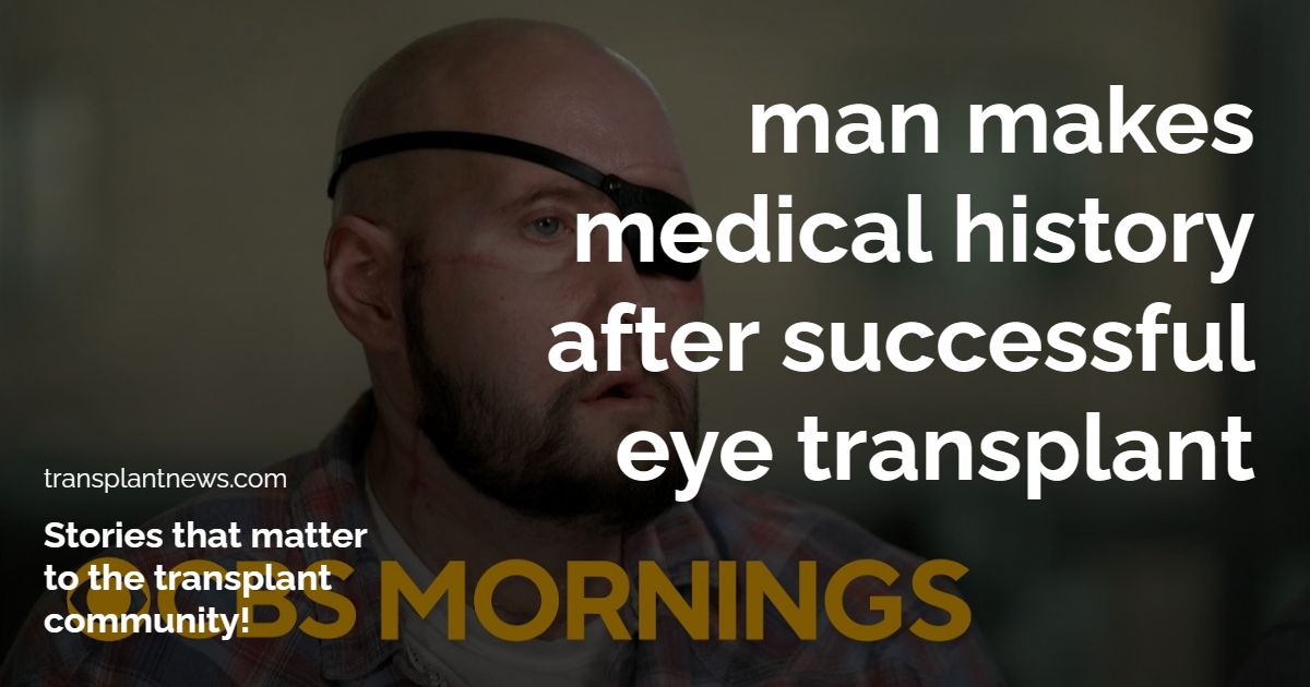 Man makes medical history after successful eye transplant