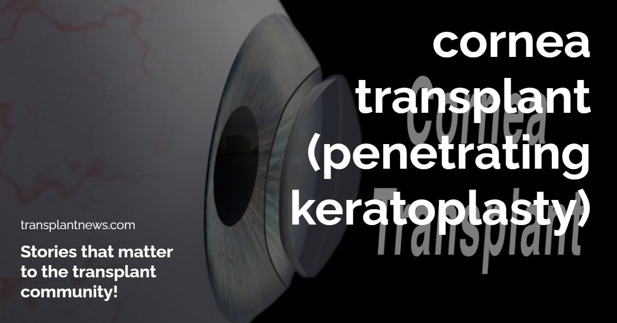 Cornea Transplant (Penetrating Keratoplasty)