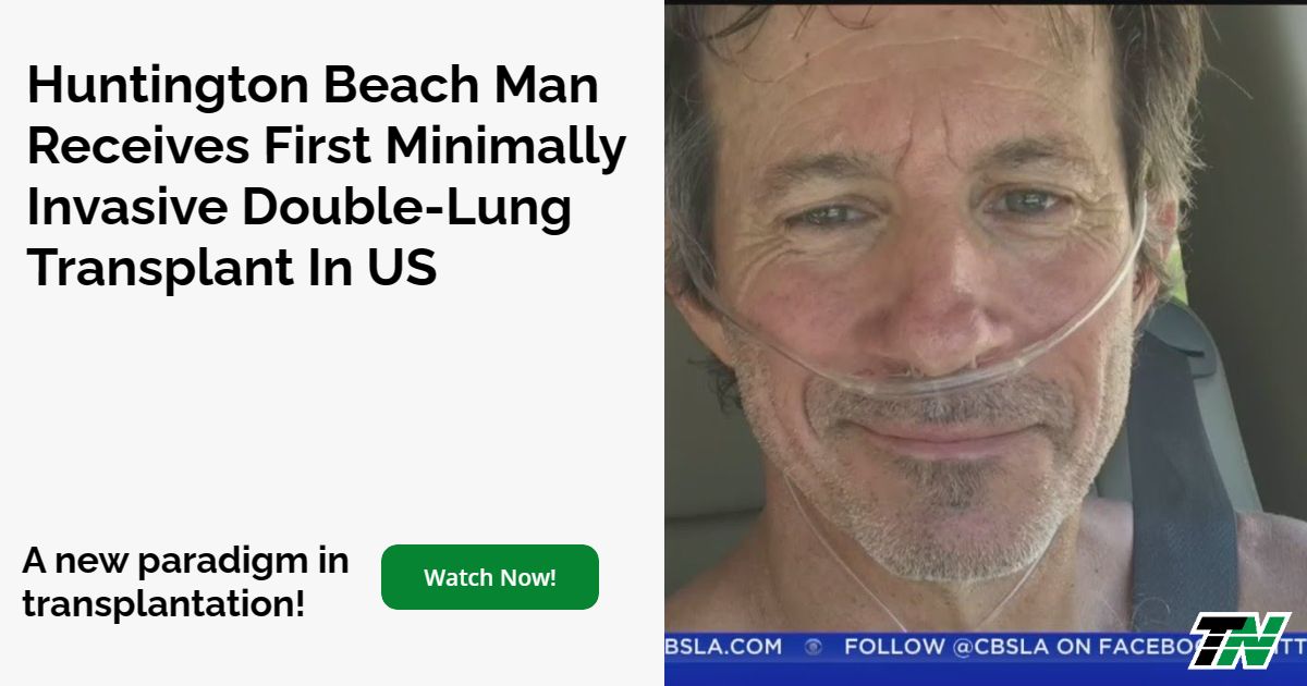 Huntington Beach Man Receives First Minimally Invasive Double-Lung Transplant In US