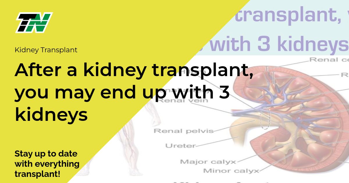 After a kidney transplant, you may end up with 3 kidneys