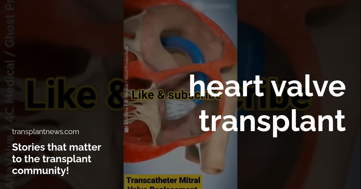 heart valve transplant