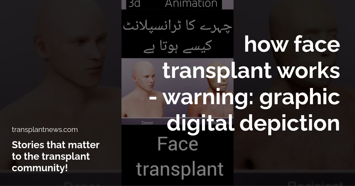 How Face Transplant Works – WARNING: Graphic Digital Depiction