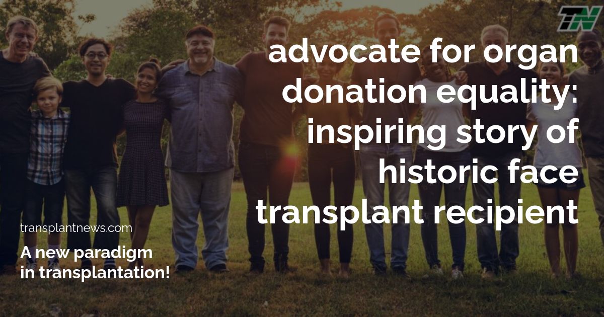 Advocate for Organ Donation Equality: Inspiring Story of Historic Face Transplant Recipient