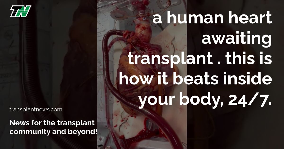 A human heart awaiting transplant . This is how it beats inside your body, 24/7.