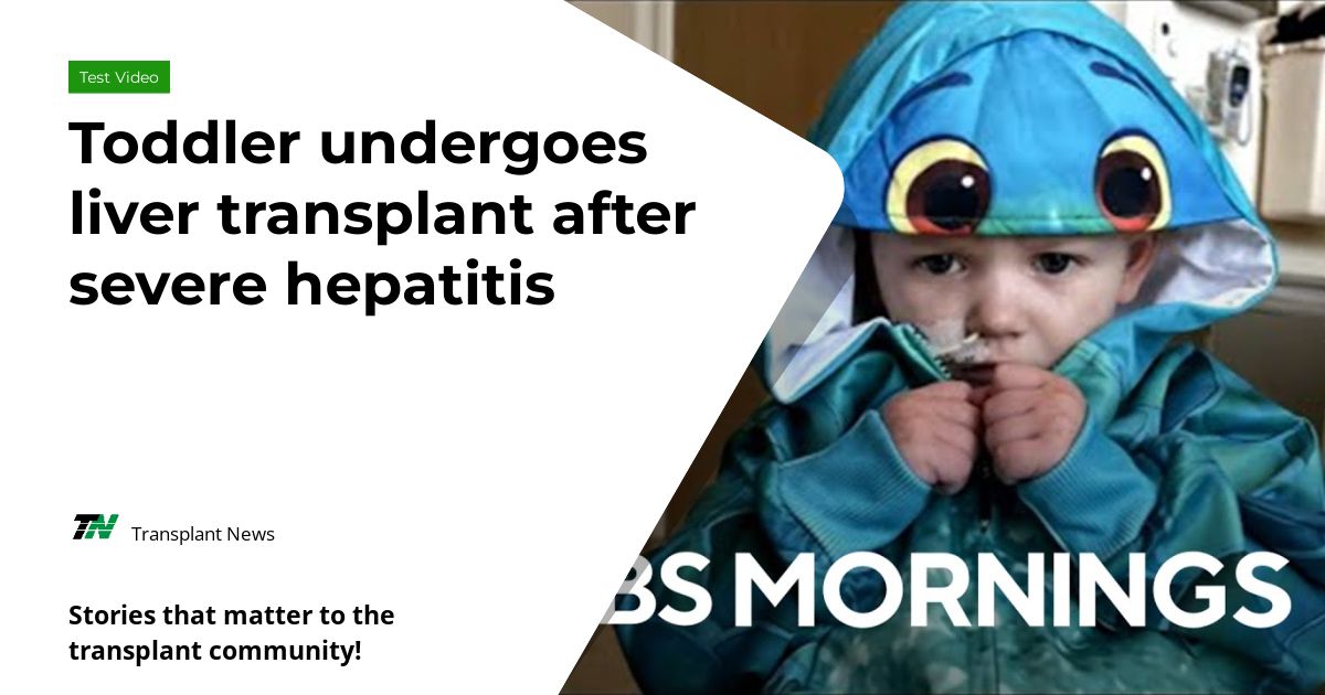 Toddler undergoes liver transplant after severe hepatitis