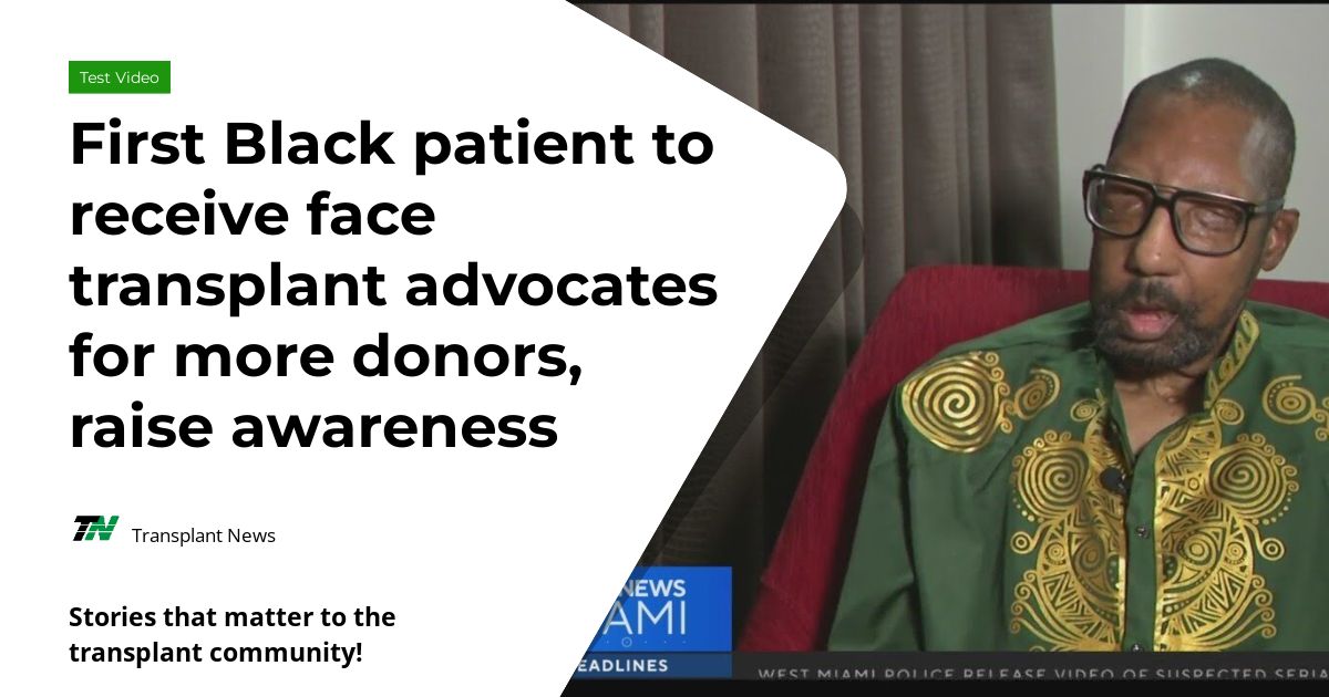First Black patient to receive face transplant advocates for more donors, raise awareness