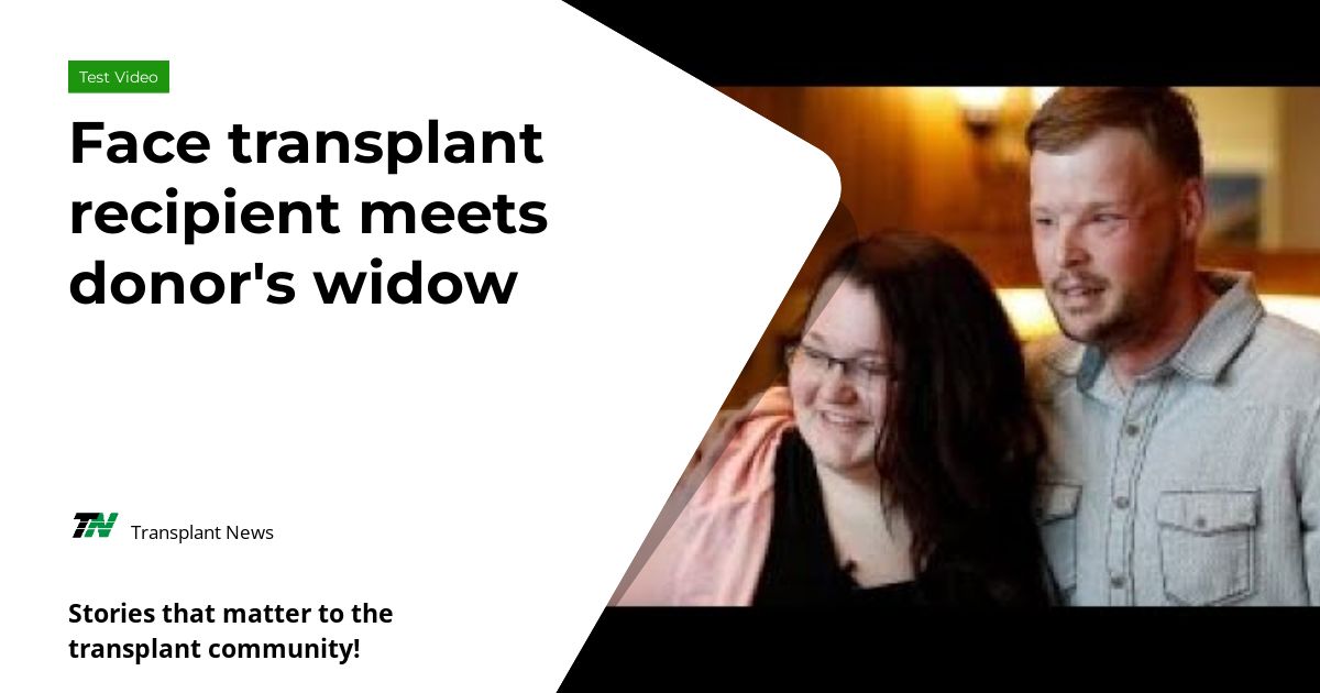 Face transplant recipient meets donor’s widow