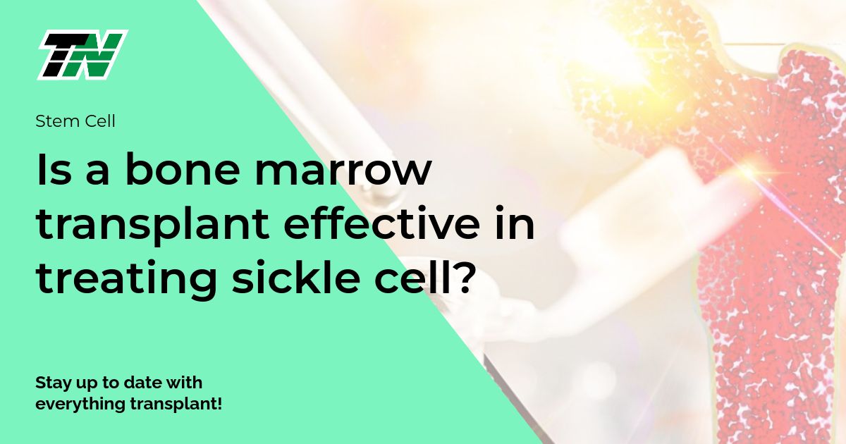 Is a bone marrow transplant effective in treating sickle cell?