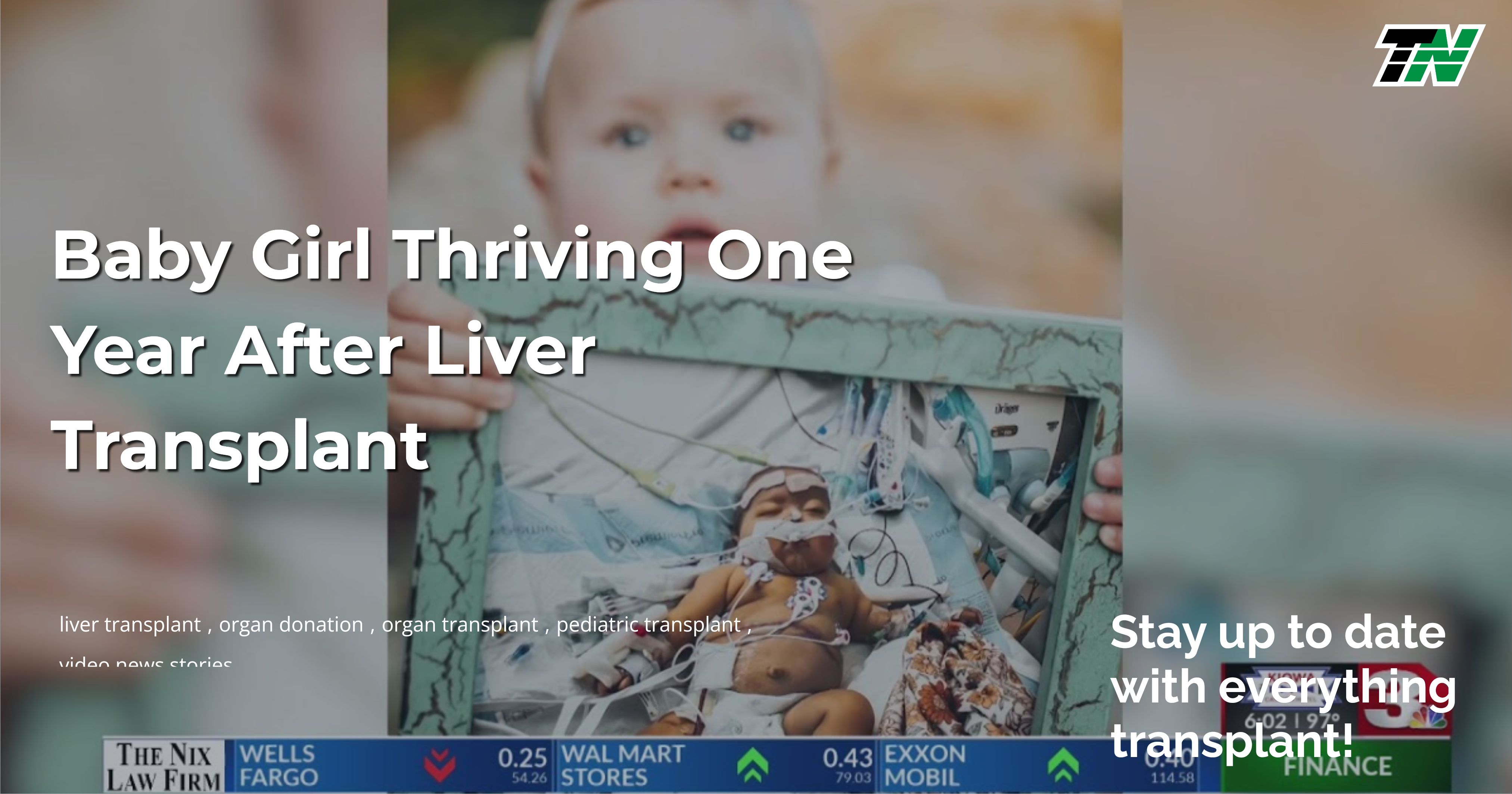 Baby Girl Thriving One Year After Liver Transplant