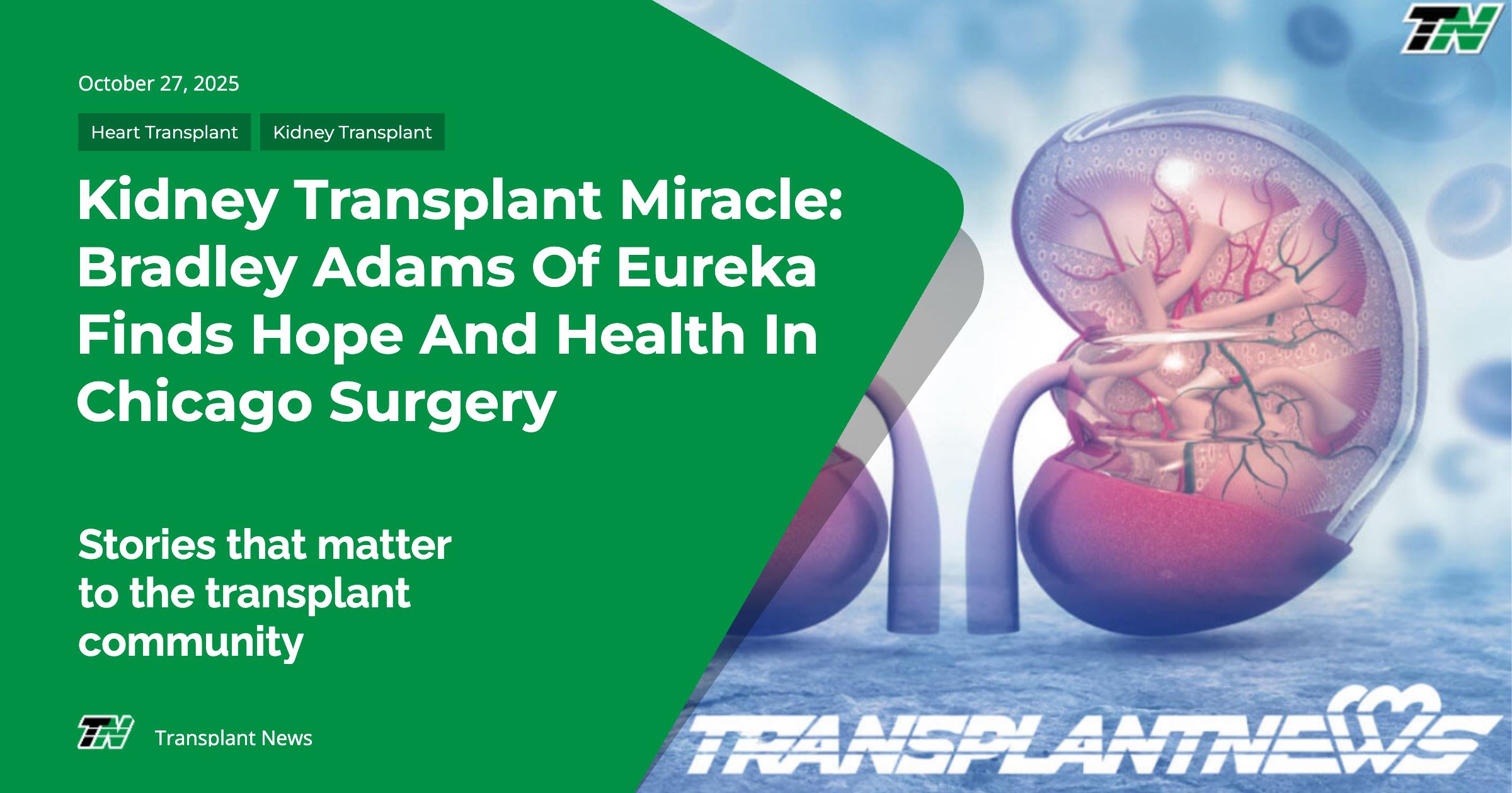 Kidney Transplant Miracle: Bradley Adams of Eureka Finds Hope and Health in Chicago Surgery
