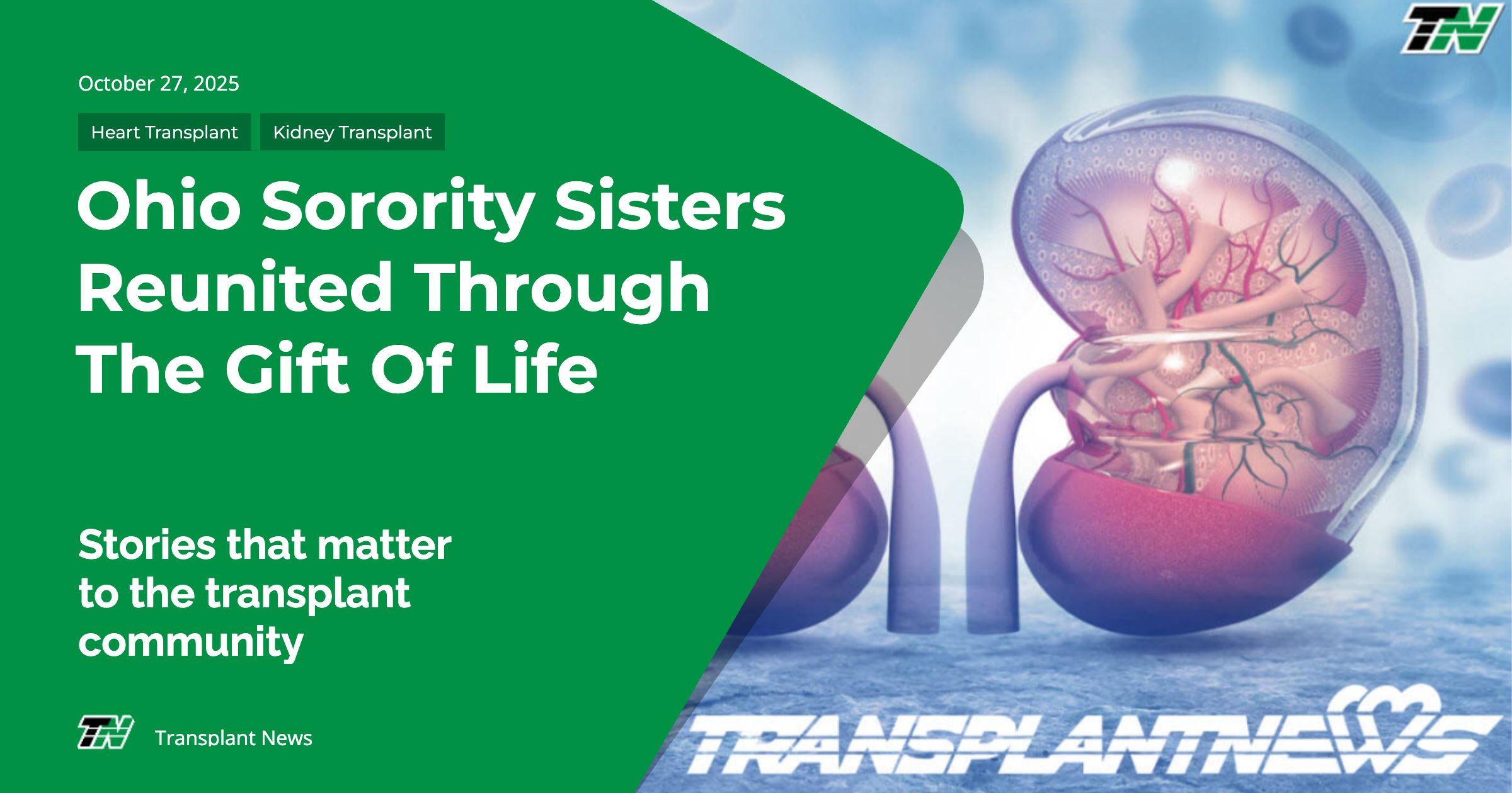 Ohio Sorority Sisters Reunited Through The Gift Of Life