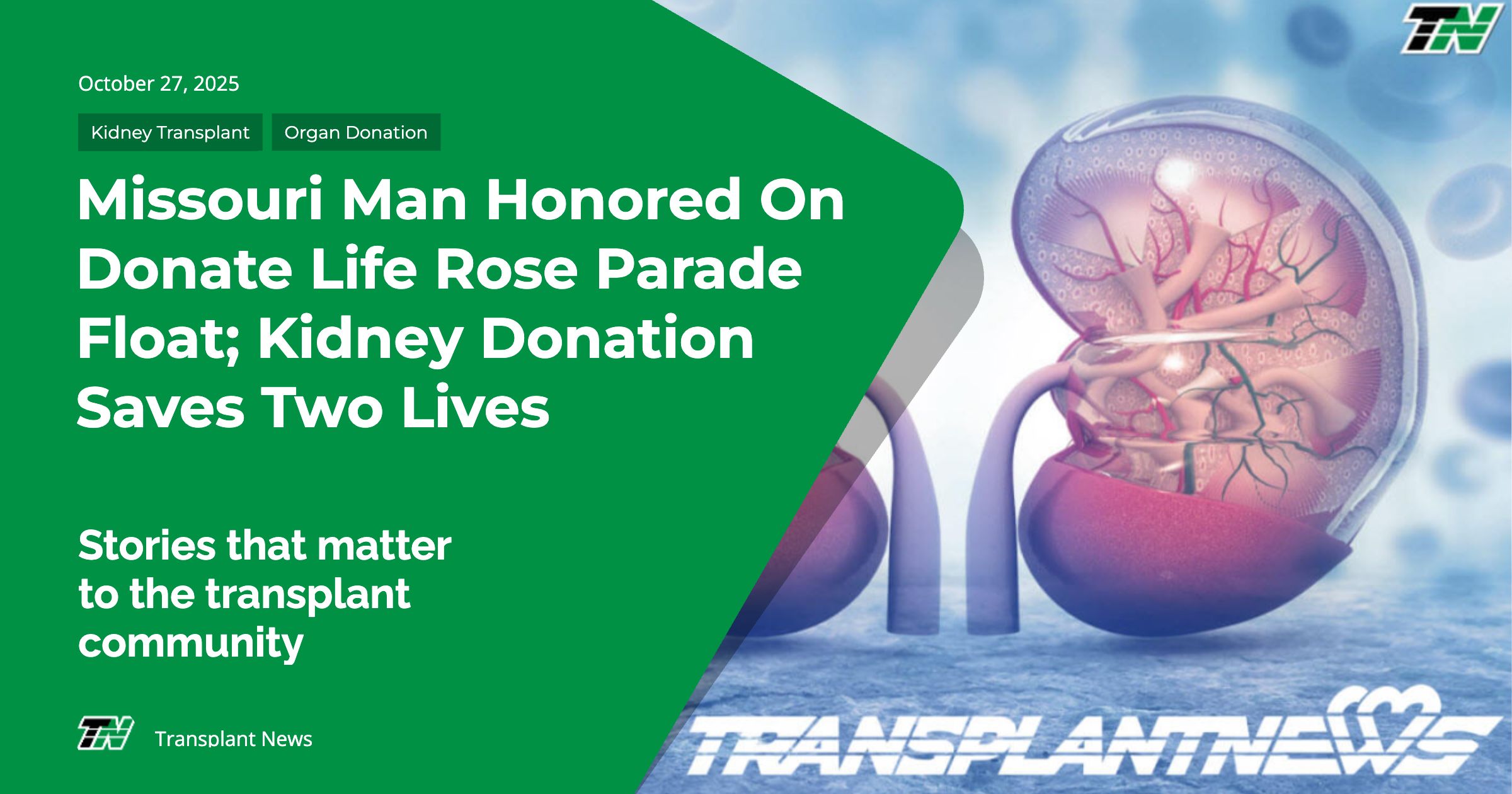 Missouri Man Honored On Donate Life Rose Parade Float; Kidney Donation Saves Two Lives