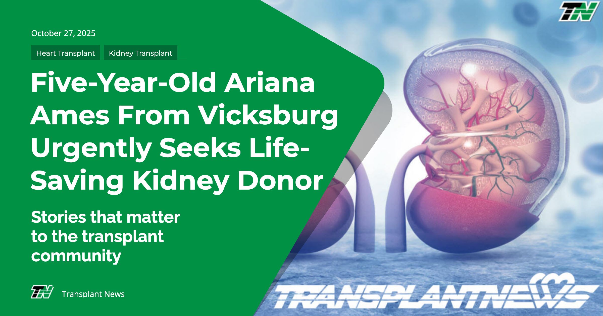 Five-Year-Old Ariana Ames From Vicksburg Urgently Seeks Life-Saving Kidney Donor