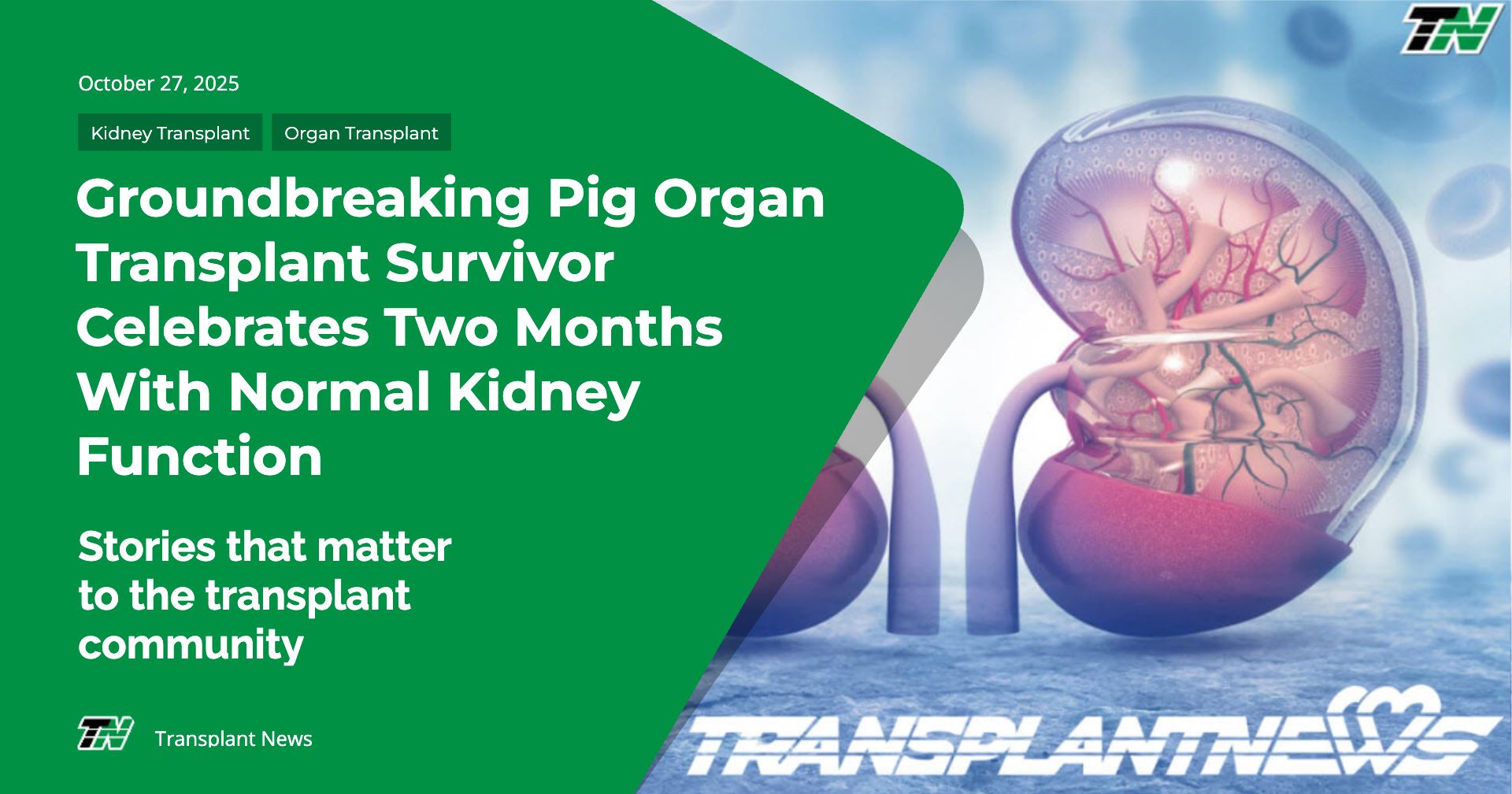 Groundbreaking Pig Organ Transplant Survivor Celebrates Two Months with Normal Kidney Function