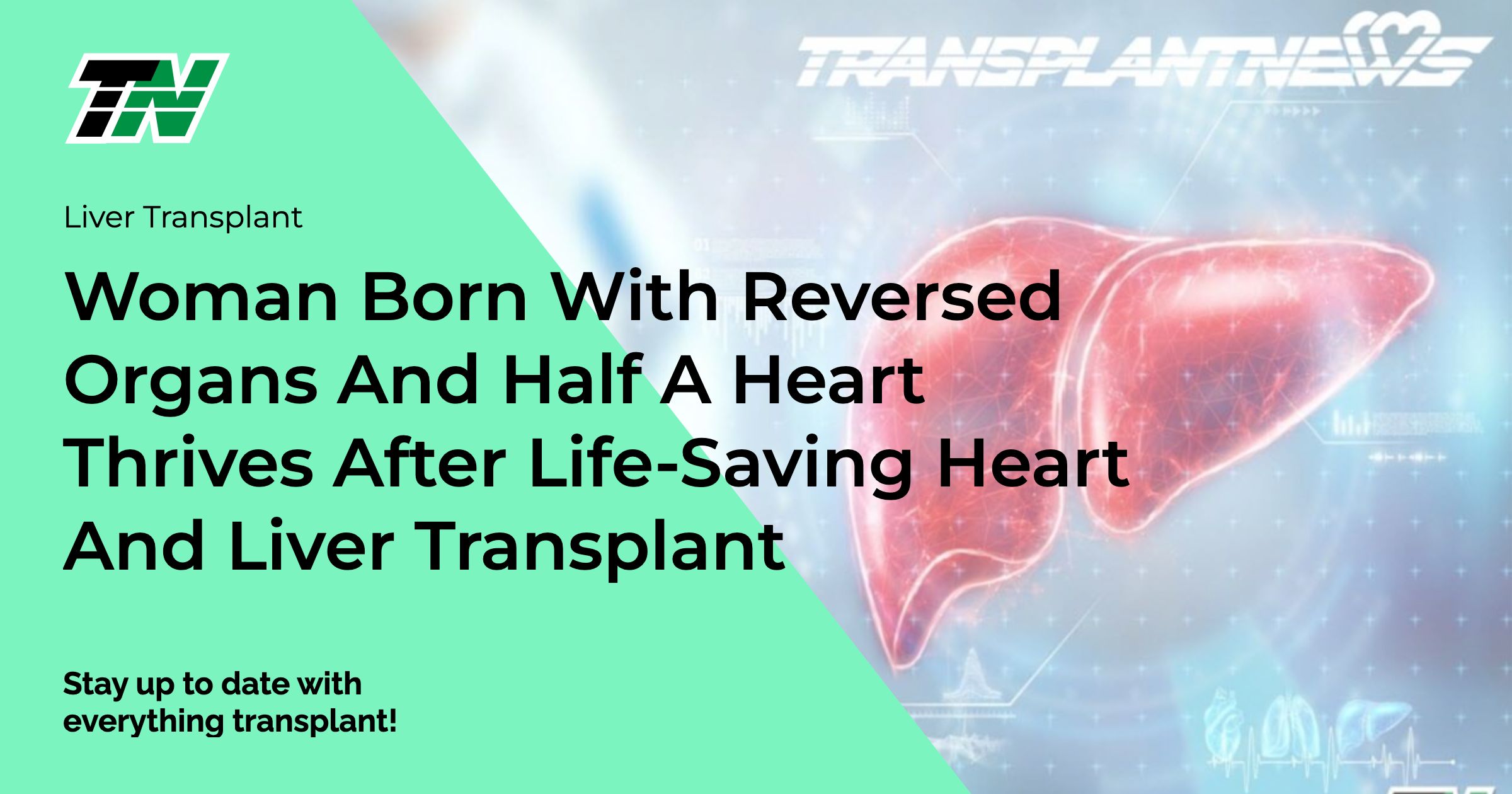 Woman Born With Reversed Organs and Half a Heart Thrives After Life-Saving Heart and Liver Transplant
