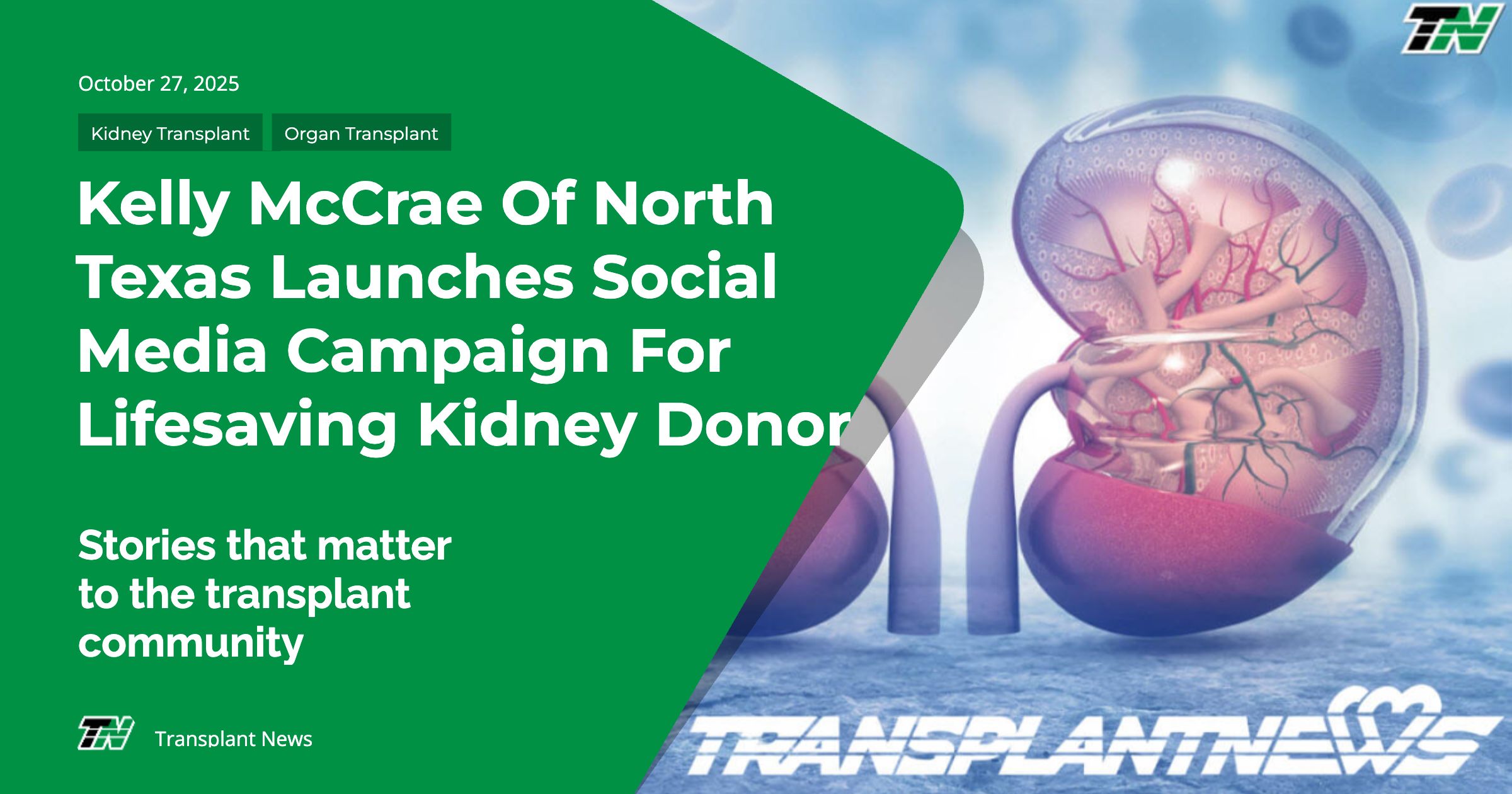 Kelly McCrae of North Texas Launches Social Media Campaign for Lifesaving Kidney Donor