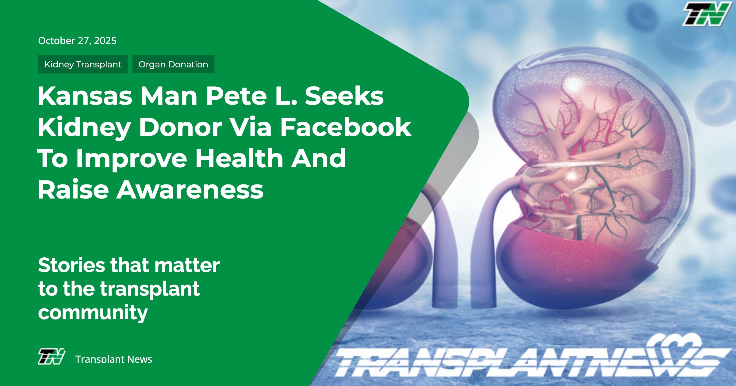 Kansas Man Pete L. Seeks Kidney Donor via Facebook to Improve Health and Raise Awareness
