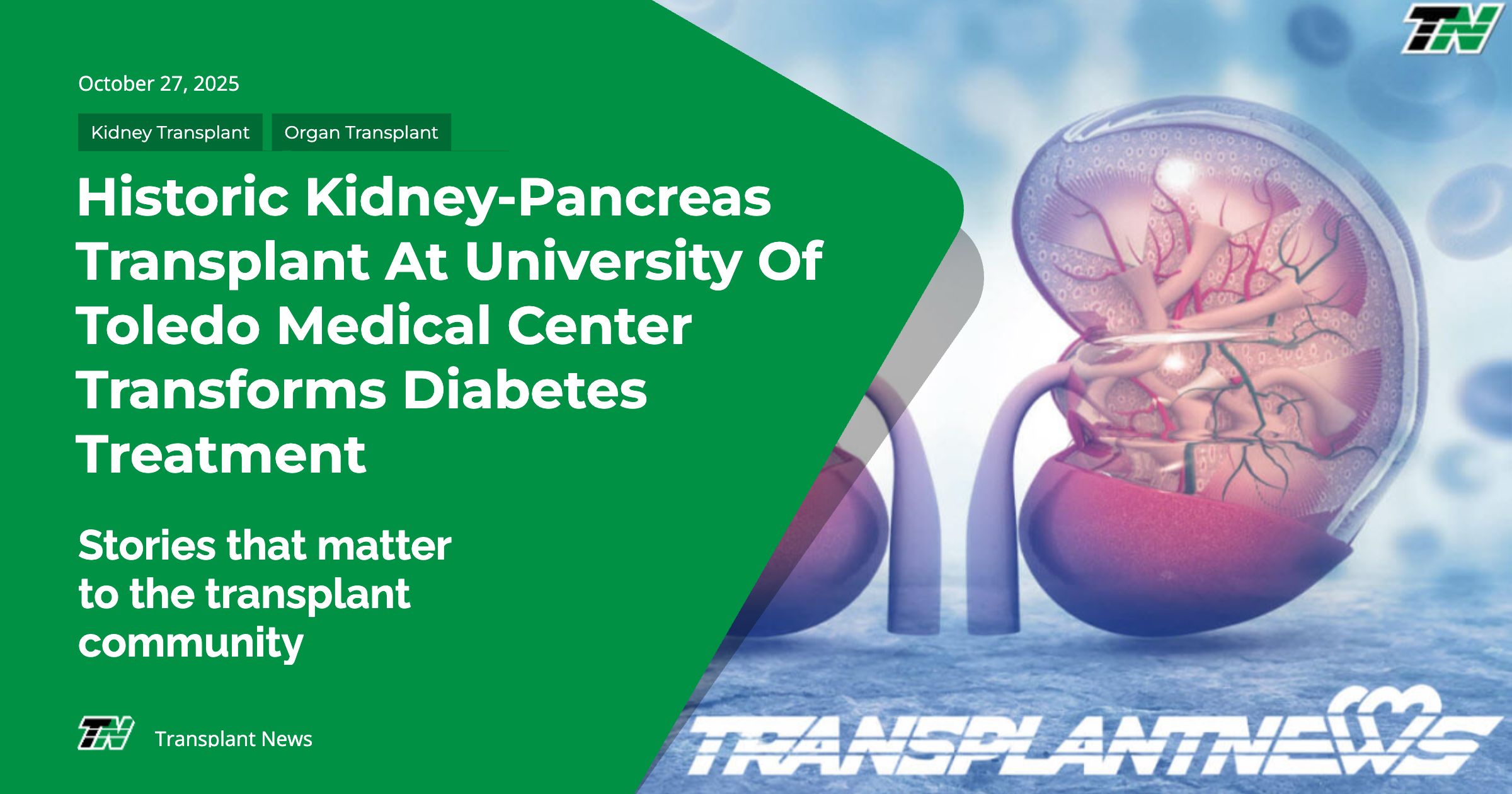 Historic Kidney-Pancreas Transplant at University of Toledo Medical Center Transforms Diabetes Treatment
