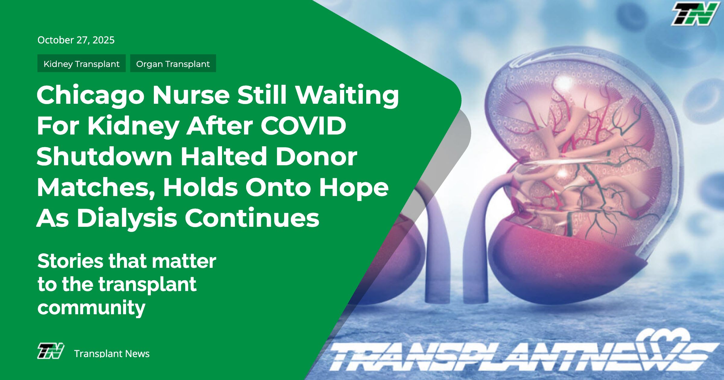 Chicago Nurse Still Waiting For Kidney After COVID Shutdown Halted Donor Matches, Holds Onto Hope As Dialysis Continues