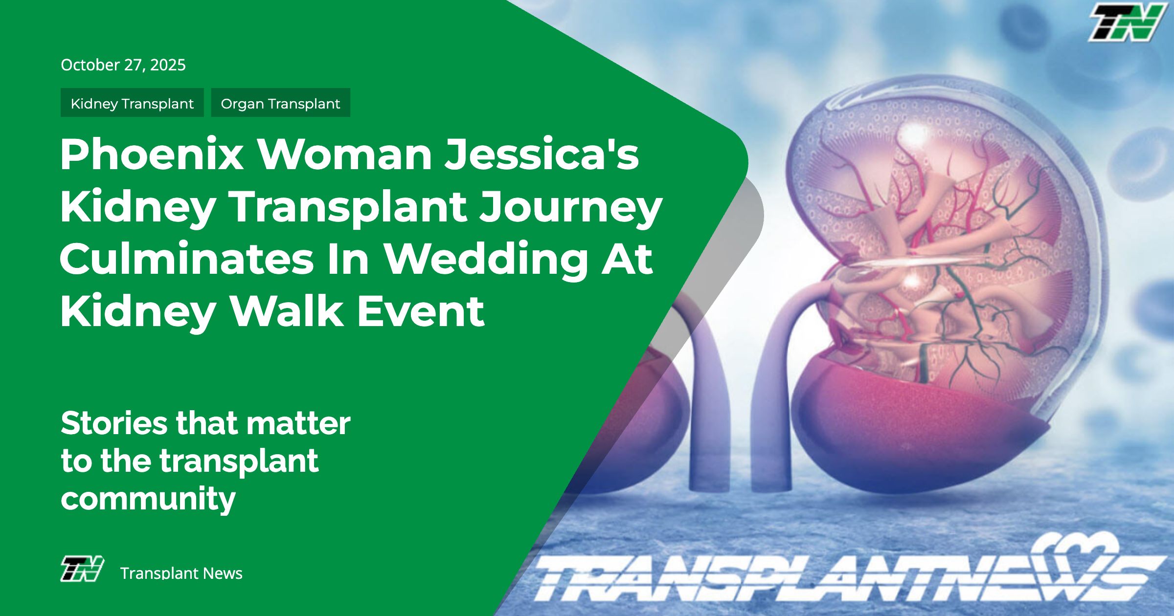 Phoenix Woman Jessica’s Kidney Transplant Journey Culminates in Wedding at Kidney Walk Event
