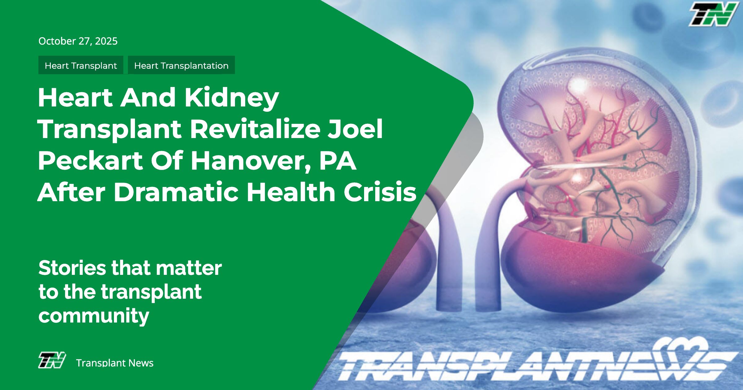 Heart and Kidney Transplant Revitalize Joel Peckart of Hanover, PA After Dramatic Health Crisis