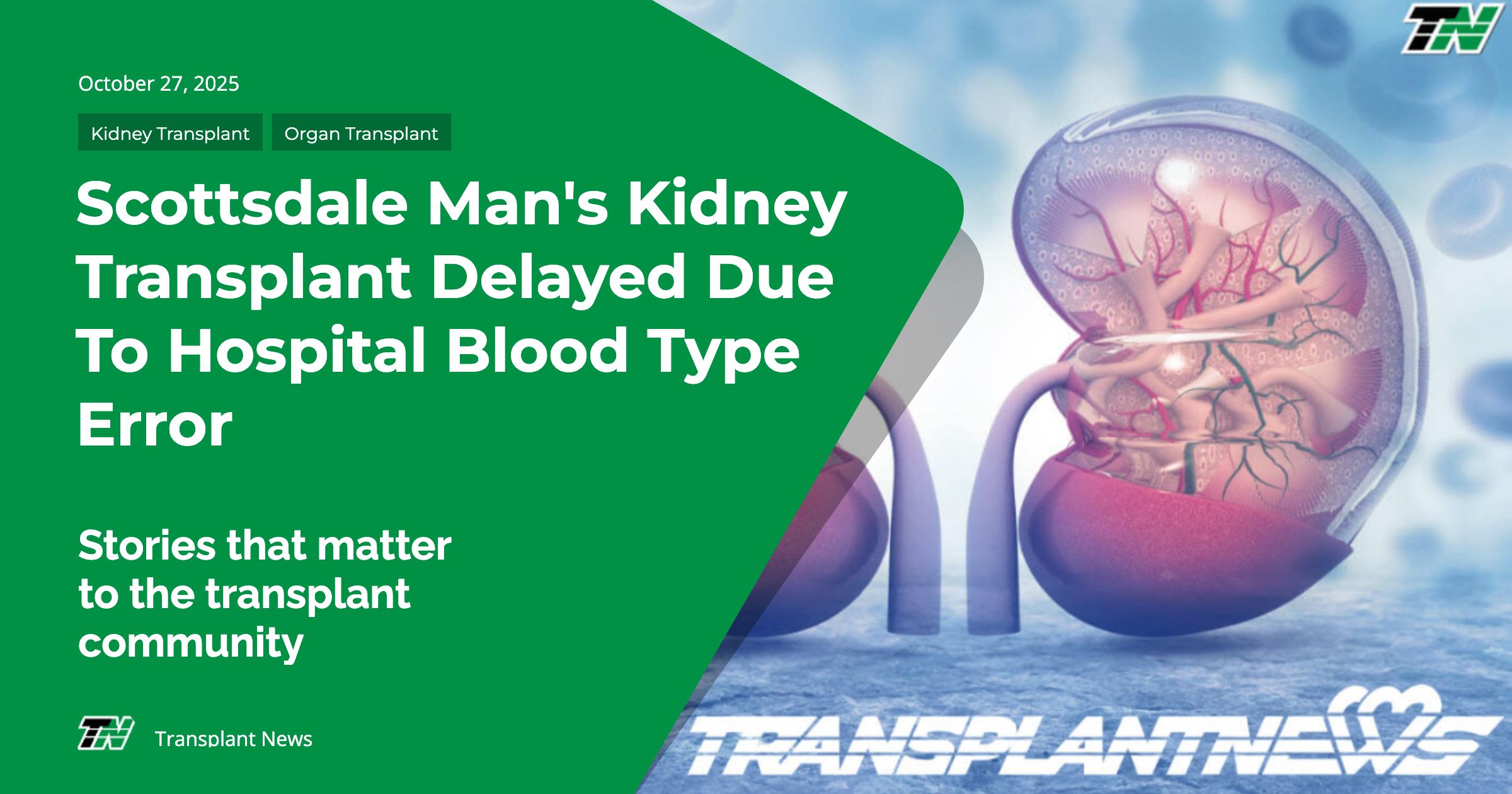 Scottsdale Man’s Kidney Transplant Delayed Due to Hospital Blood Type Error