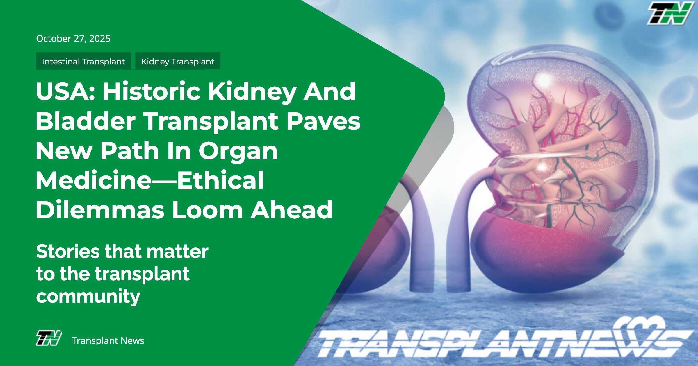 USA: Historic Kidney And Bladder Transplant Paves New Path In Organ Medicine—Ethical Dilemmas Loom Ahead