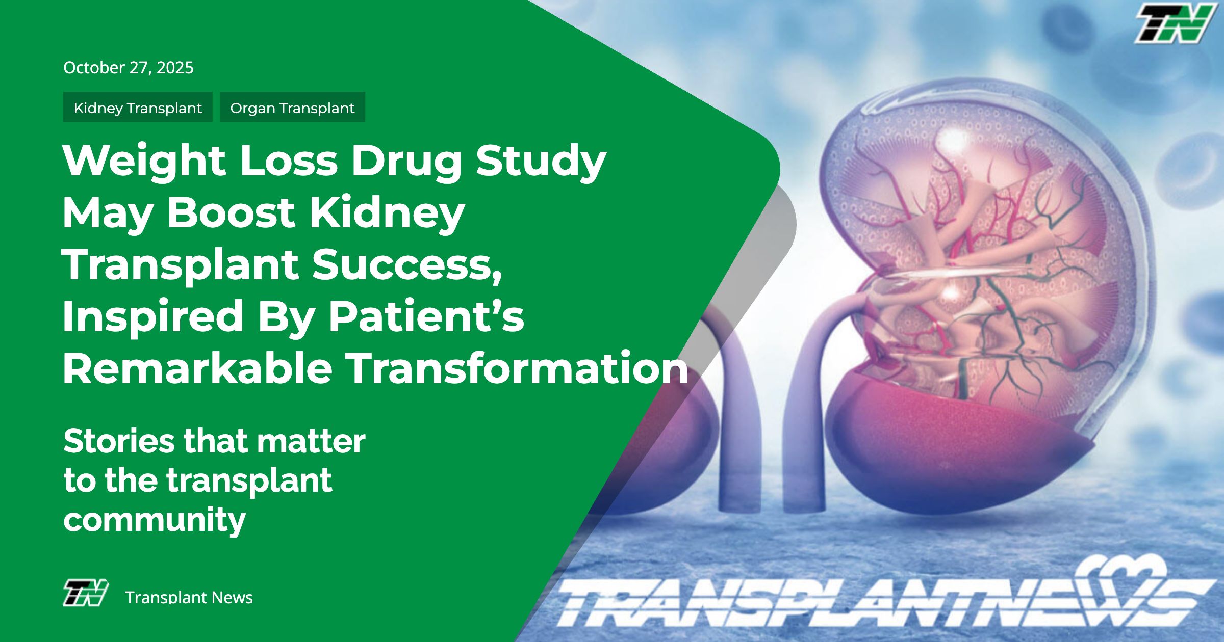 Weight Loss Drug Study May Boost Kidney Transplant Success, Inspired By Patient’s Remarkable Transformation