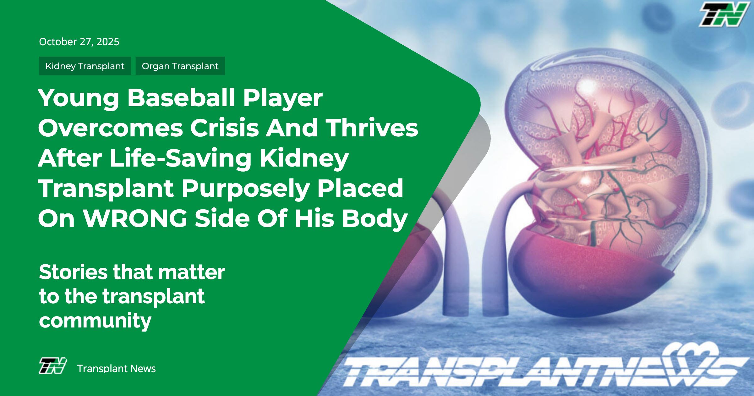 Young Baseball Player Overcomes Crisis And Thrives After Life-Saving Kidney Transplant Purposely Placed On WRONG Side of His Body