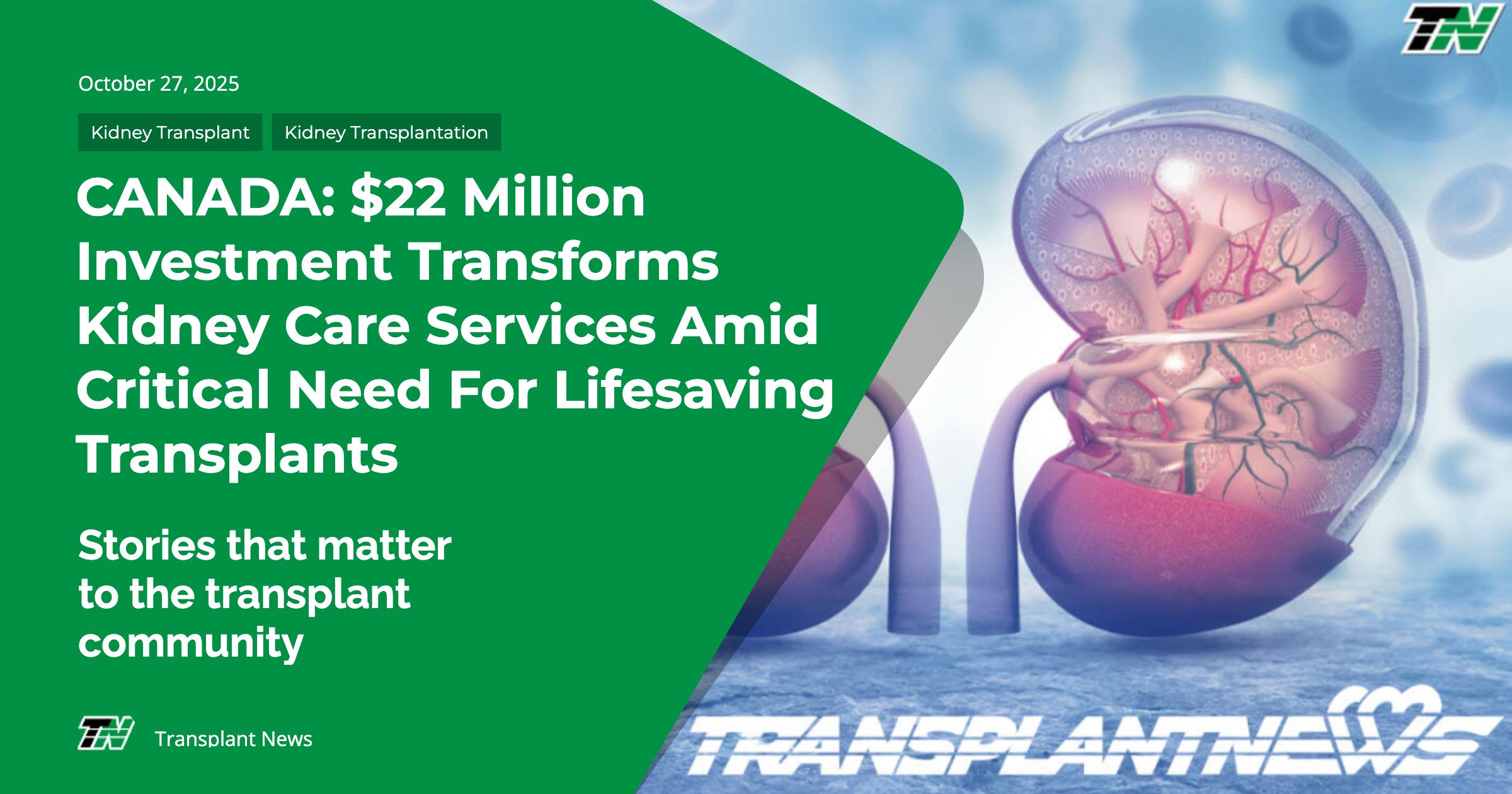 CANADA: $22 Million Investment Transforms Kidney Care Services Amid Critical Need for Lifesaving Transplants