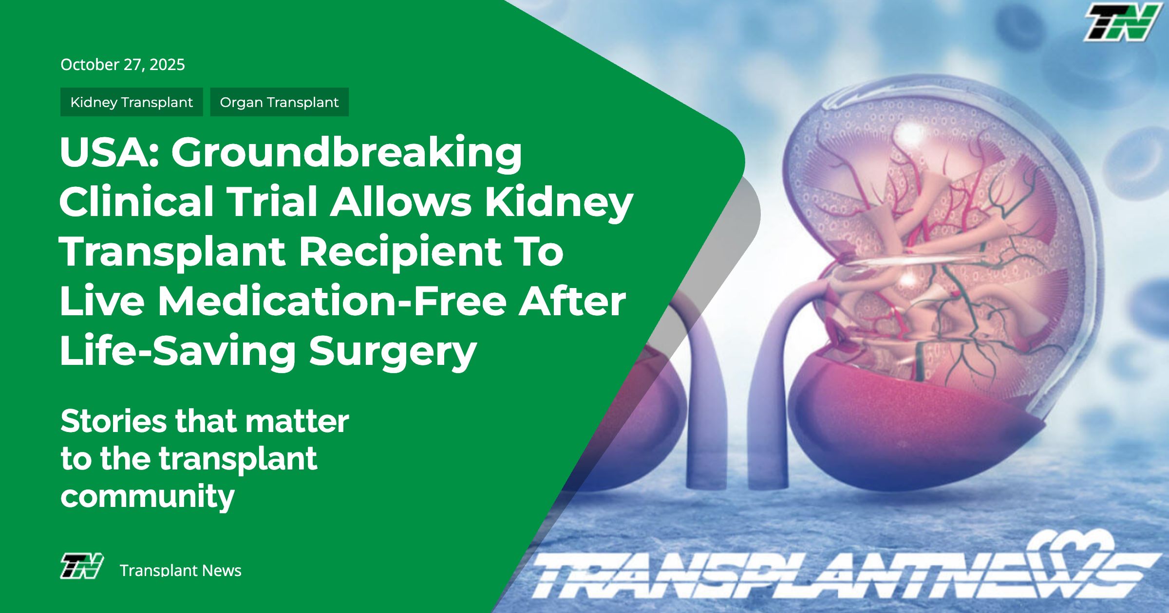 USA: Groundbreaking Clinical Trial Allows Kidney Transplant Recipient To Live Medication-Free After Life-Saving Surgery