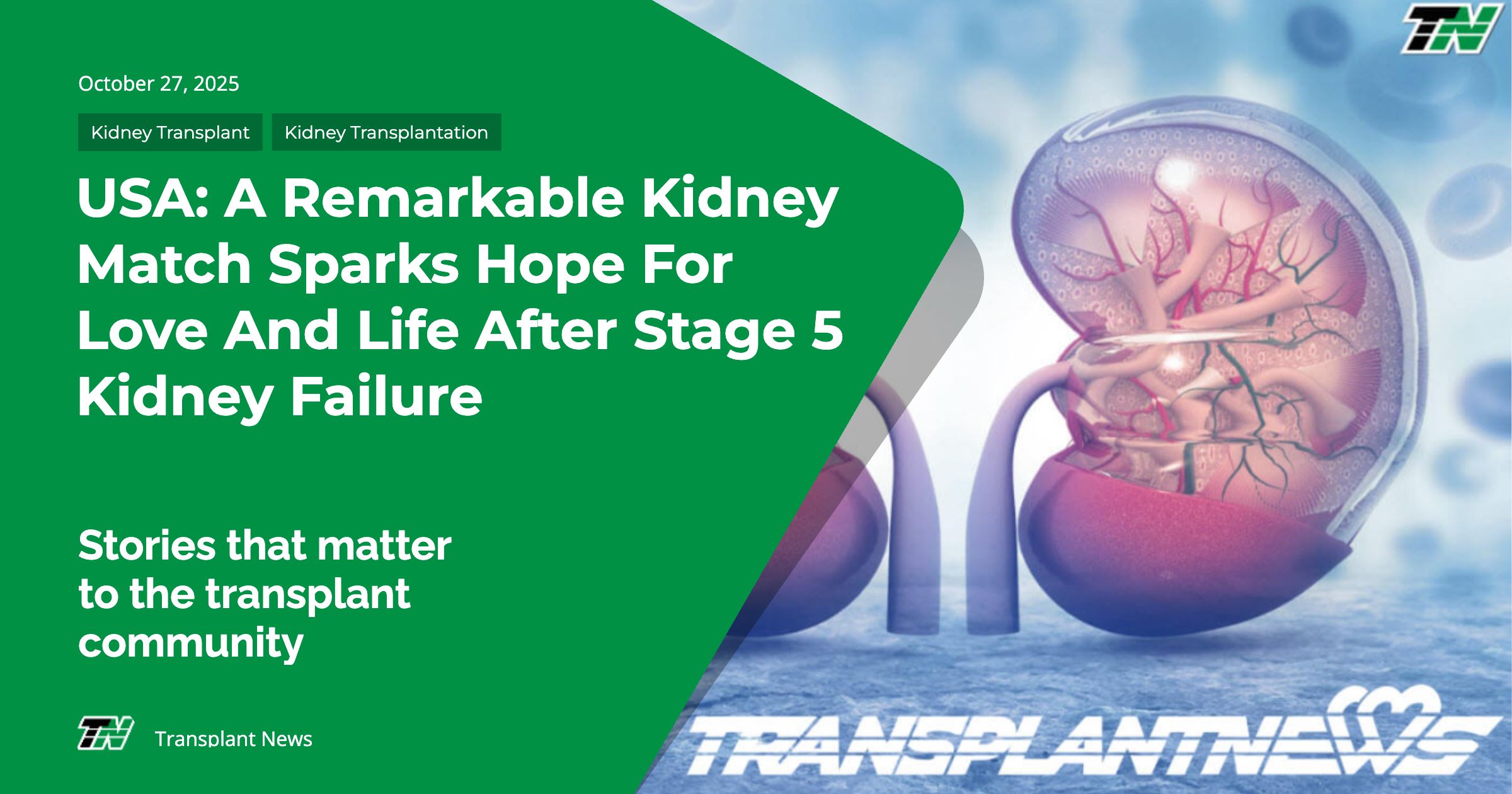 USA: A Remarkable Kidney Match Sparks Hope For Love And Life After Stage 5 Kidney Failure