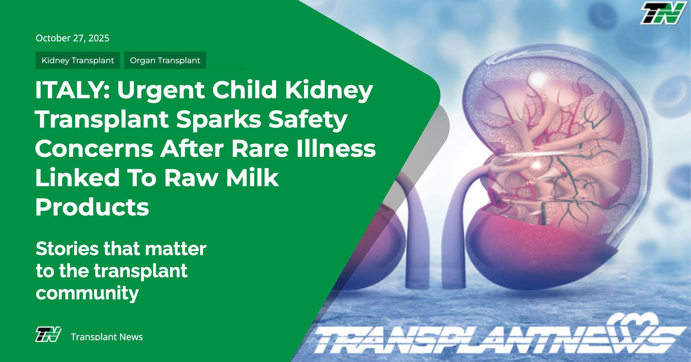 ITALY: Urgent Child Kidney Transplant Sparks Safety Concerns After Rare Illness Linked to Raw Milk Products