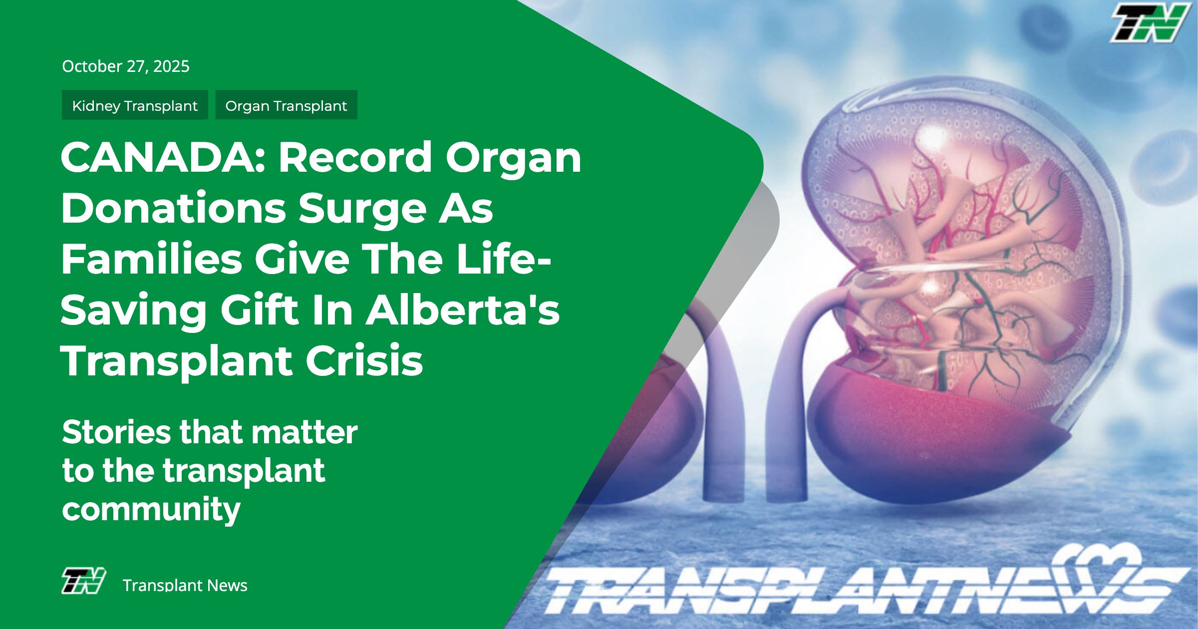 CANADA: Record Organ Donations Surge as Families Give the Life-Saving Gift in Alberta’s Transplant Crisis