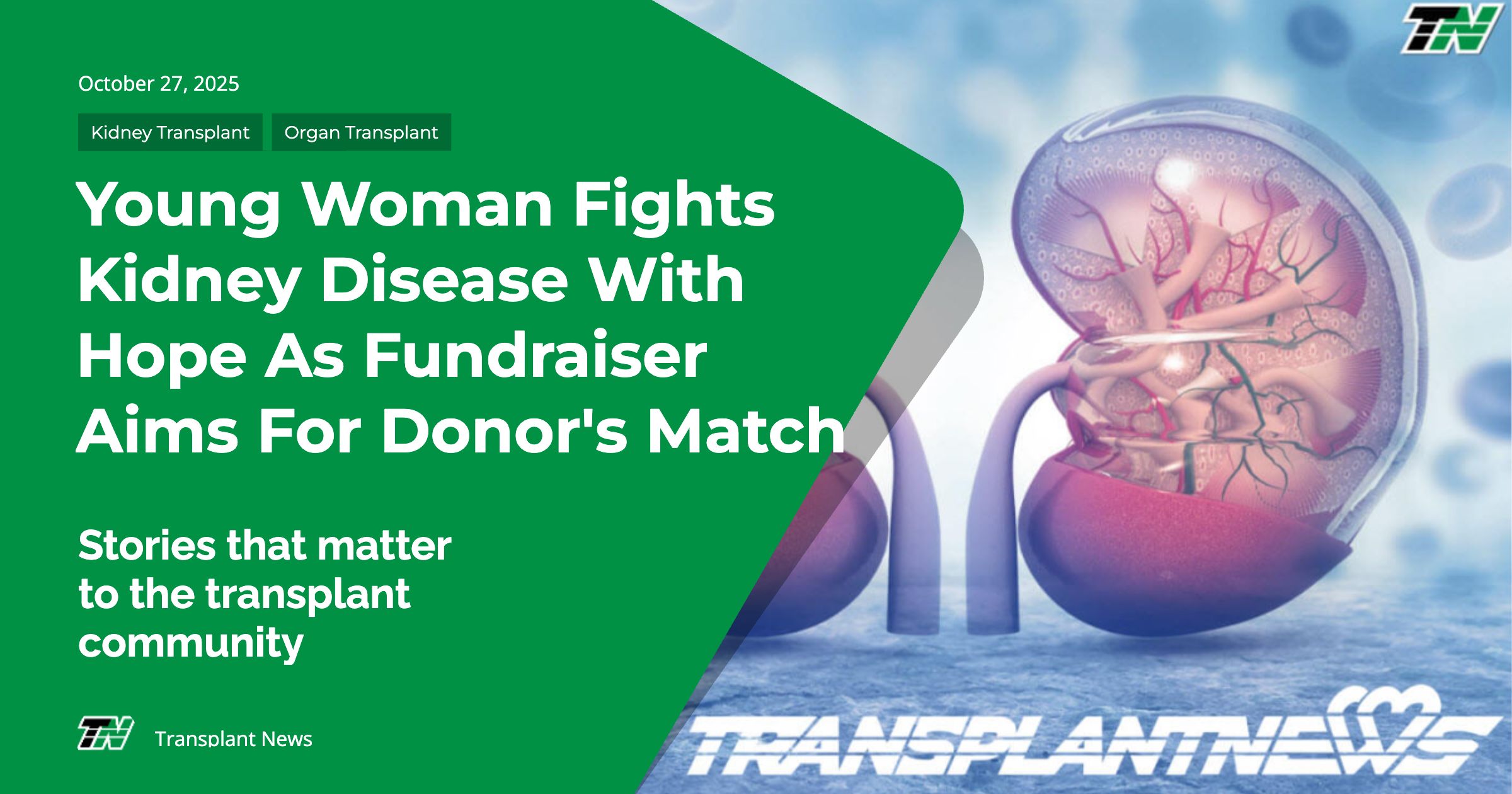 Young Woman Fights Kidney Disease With Hope As Fundraiser Aims For Donor’s Match