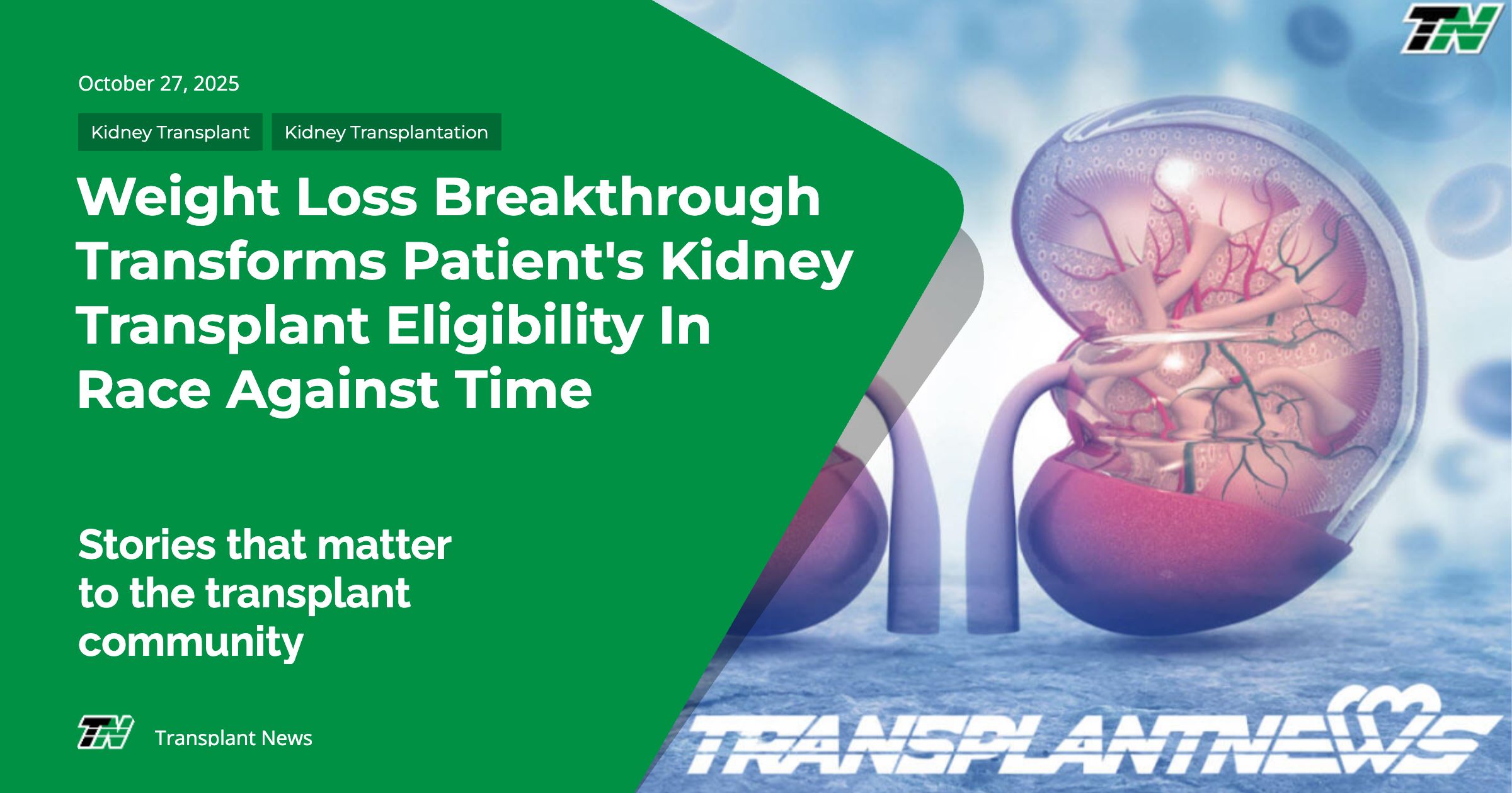 Weight Loss Breakthrough Transforms Patient’s Kidney Transplant Eligibility In Race Against Time