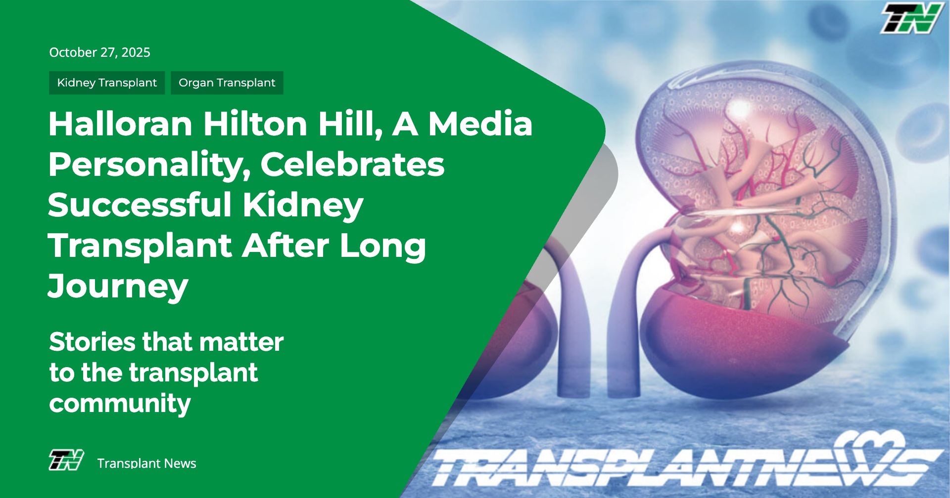 Halloran Hilton Hill, A Media Personality, Celebrates Successful Kidney Transplant After Long Journey Halloran Hilton Hill, A Media Personality, Celebrates Successful Kidney Transplant After Long Journey