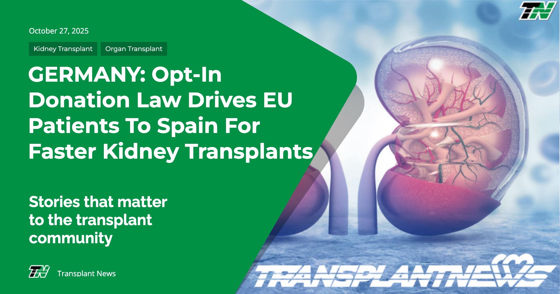 GERMANY: Opt-In Donation Law Drives EU Patients To Spain For Faster Kidney Transplants