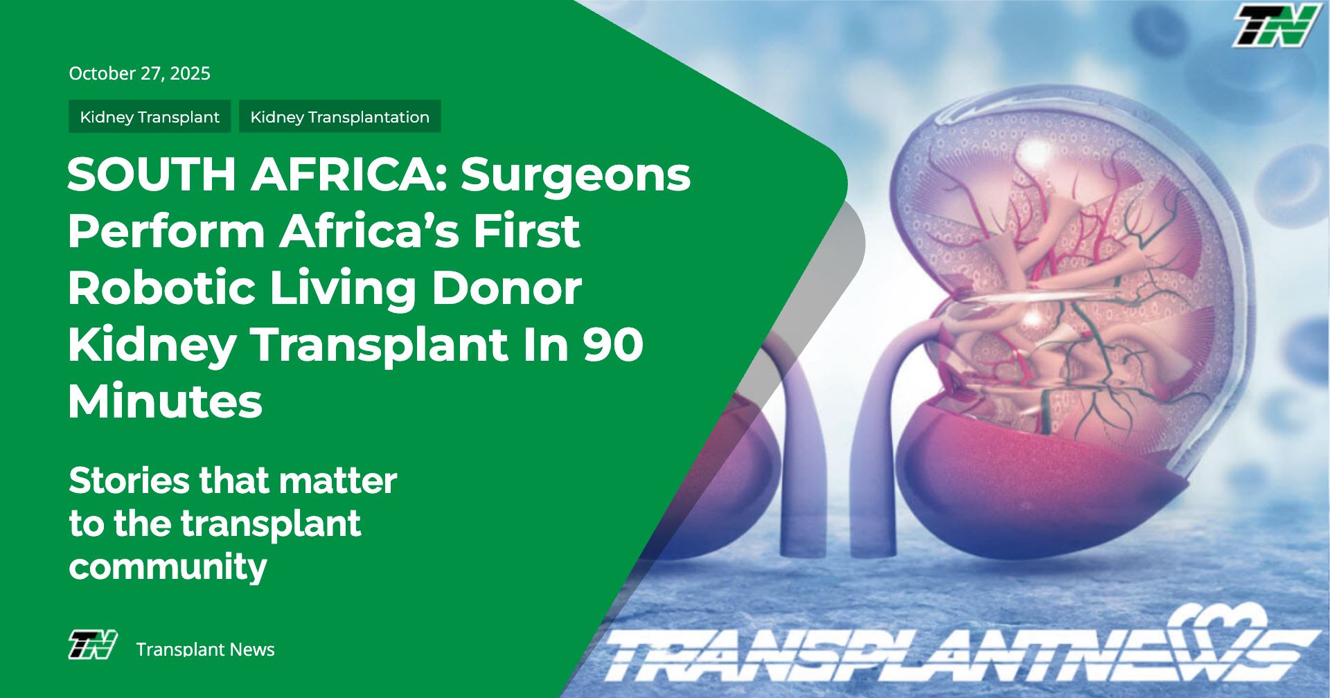 SOUTH AFRICA: Surgeons Perform Africa’s First Robotic Living Donor Kidney Transplant In 90 Minutes