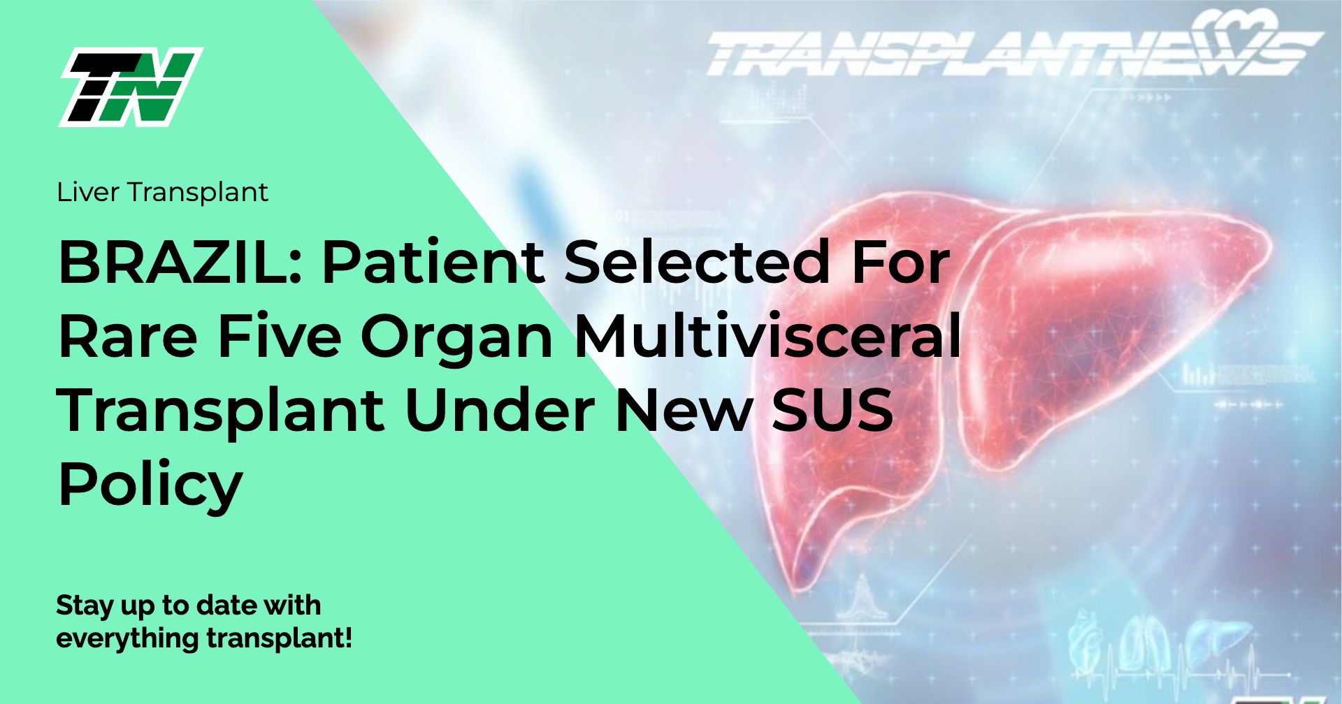 BRAZIL: Patient Selected For Rare Five Organ Multivisceral Transplant Under New SUS Policy