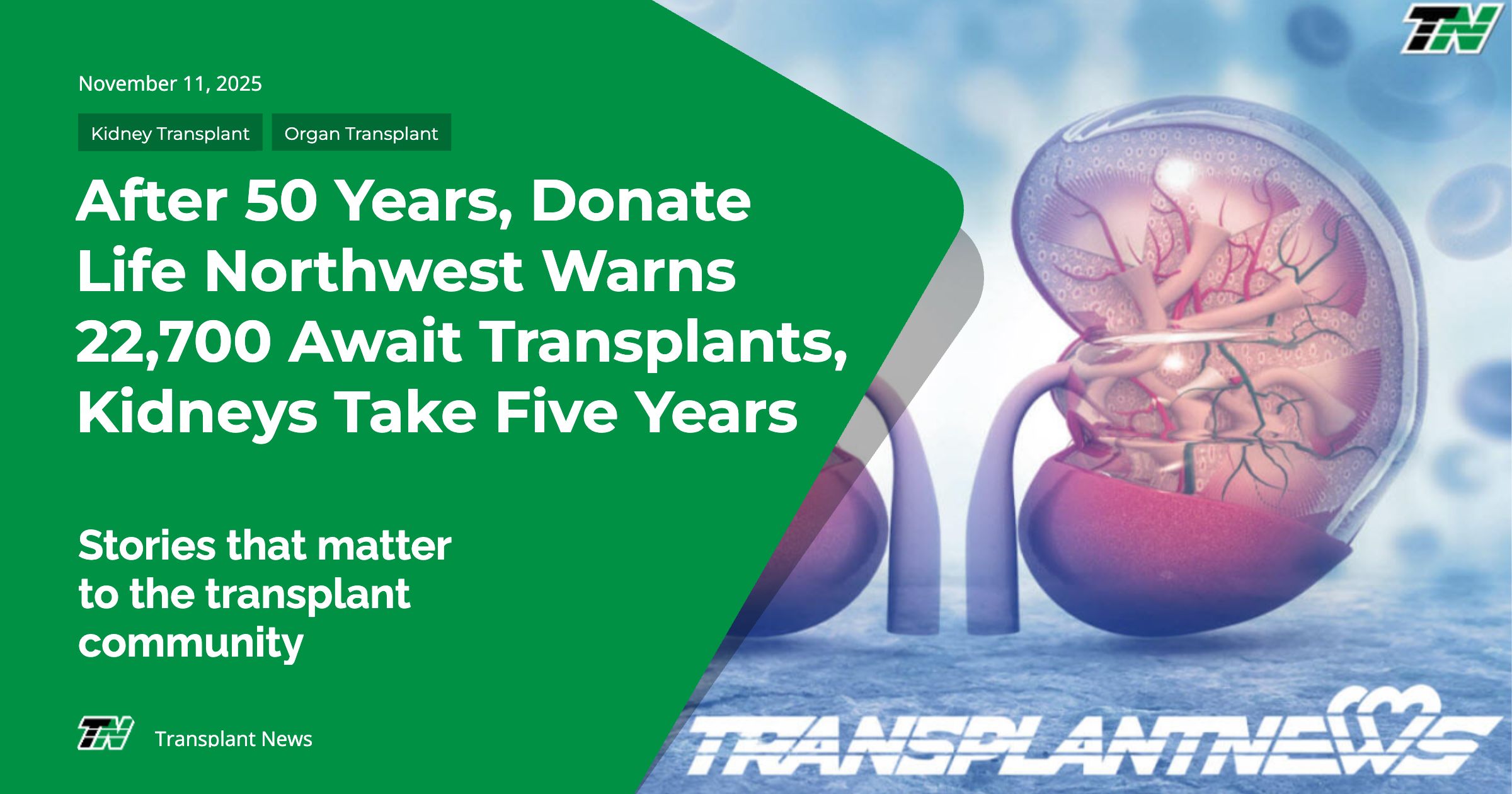After 50 Years, Donate Life Northwest Warns 22,700 Await Transplants, Kidneys Take Five Years