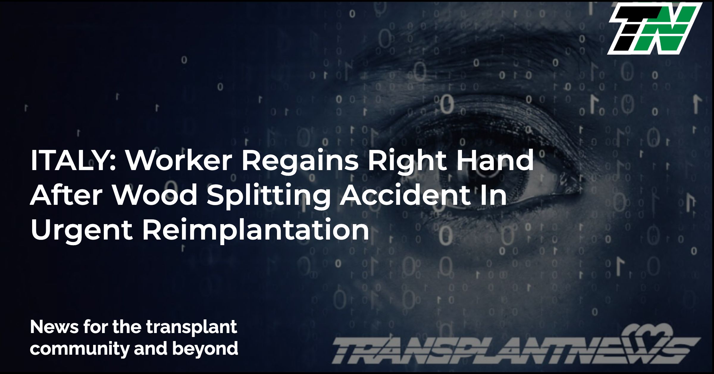 ITALY: Worker Regains Right Hand After Wood Splitting Accident In Urgent Reimplantation