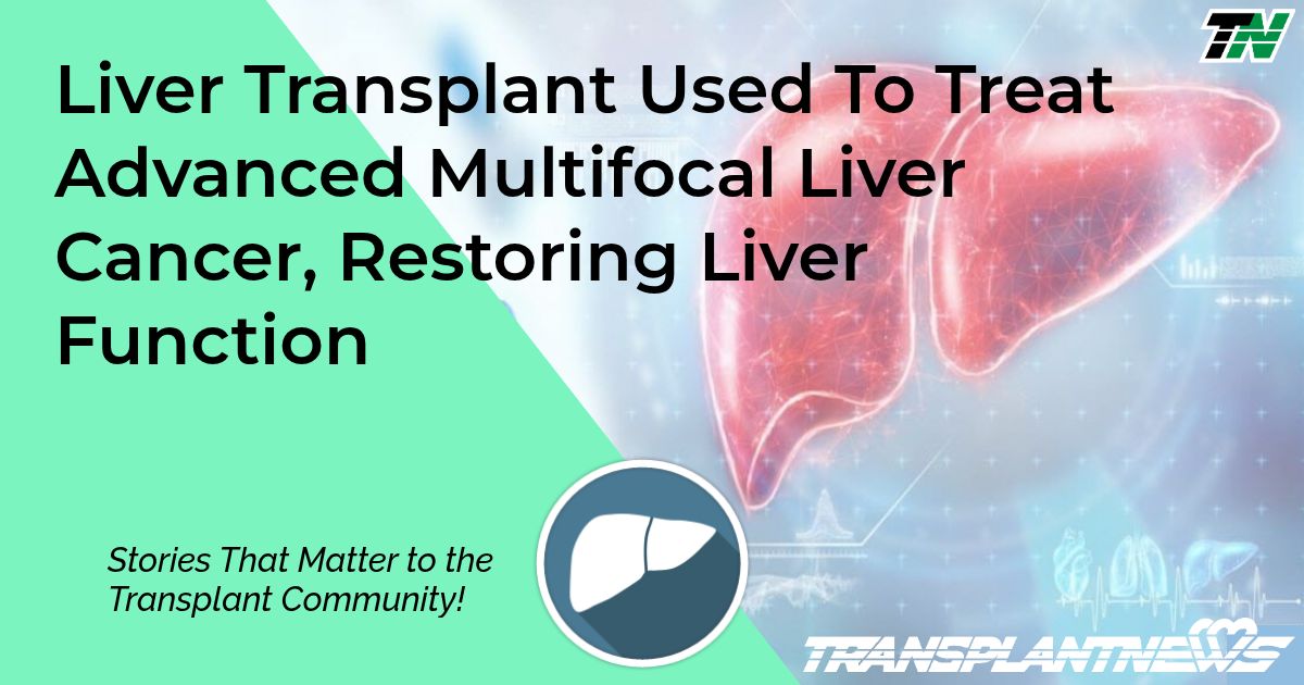 Liver Transplant Used To Treat Advanced Multifocal Liver Cancer, Restoring Liver Function